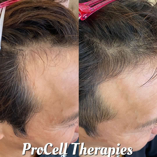 プロセルセラピーズ本体 プロセルセラピーズ | Re'ante